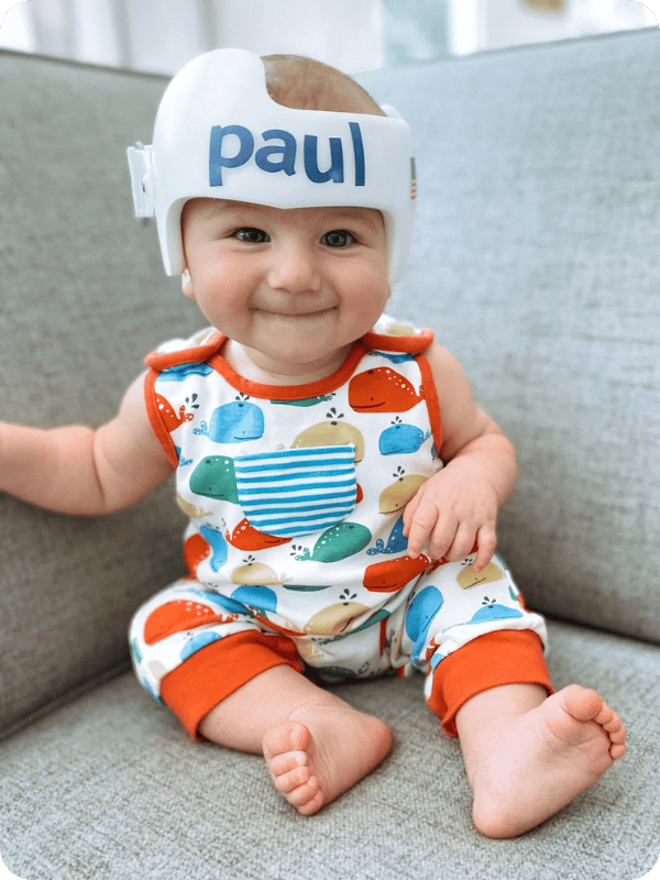 Paul wearing his cranial helmet to correct his head shape.