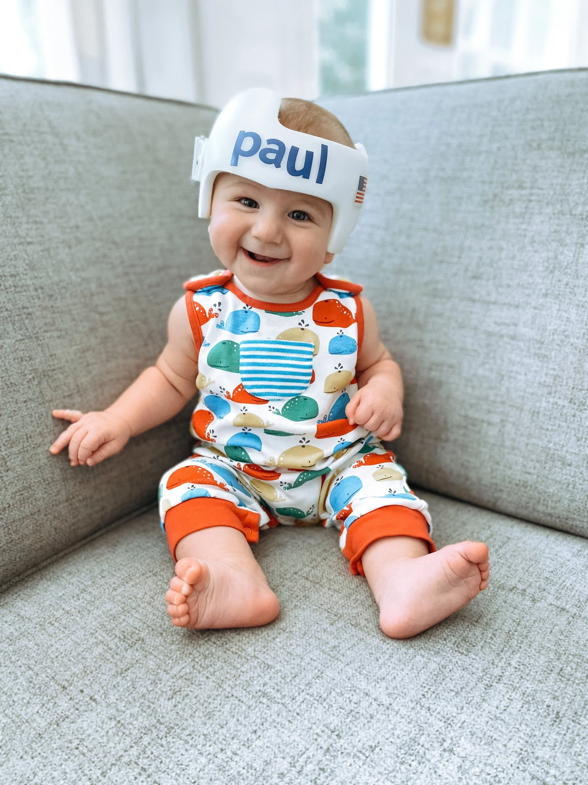 My son, Paul, at 6 months wearing his cranial helmet. 