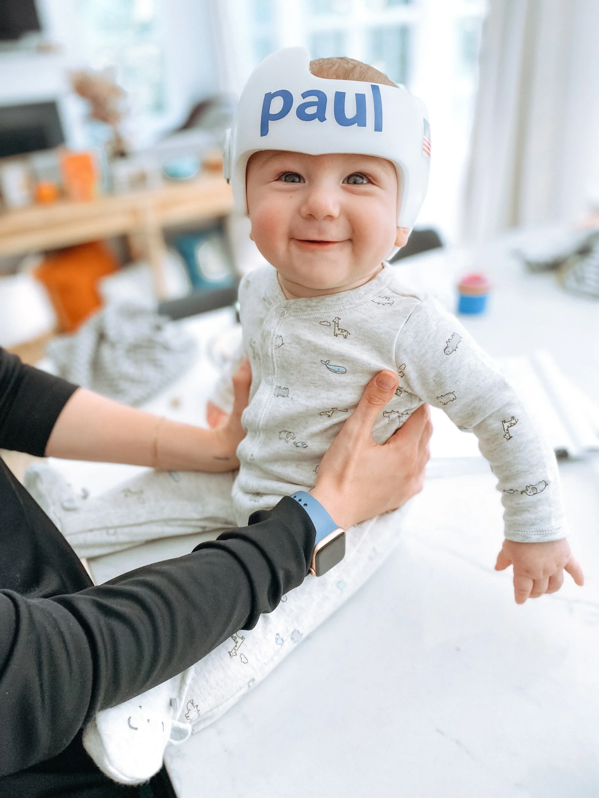  My son Paul, 7 months, wearing his cranial helmet.  