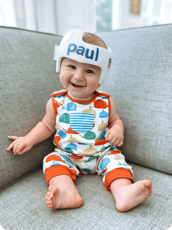My son, Paul, wearing his cranial helmet and smiling at the camera.
