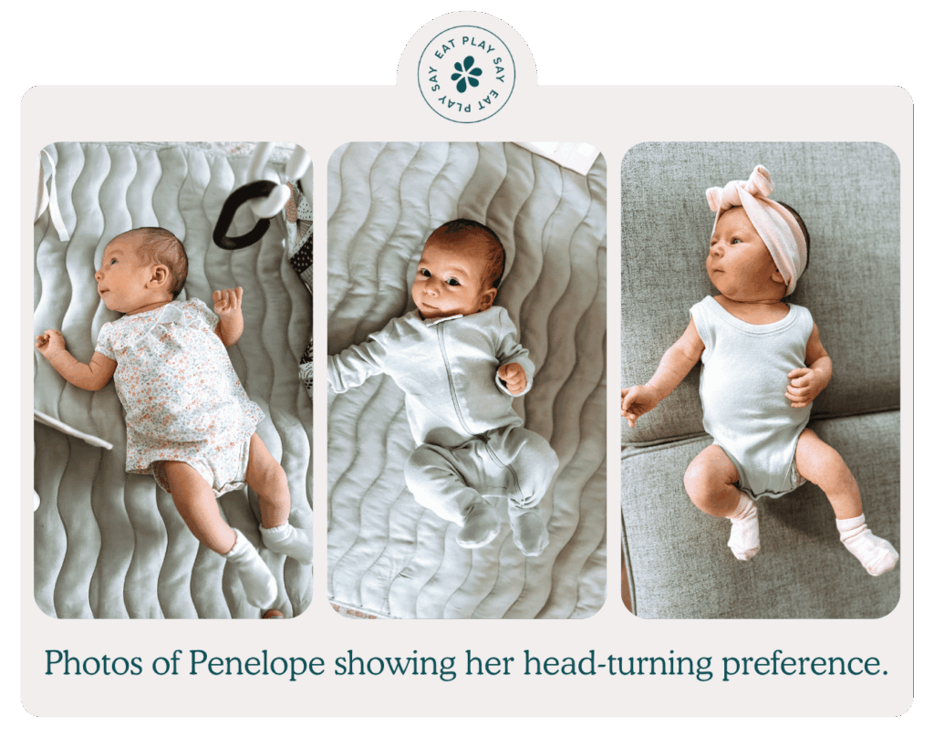 Penelope had body tension that led to a head turning preference, shown here in three photos