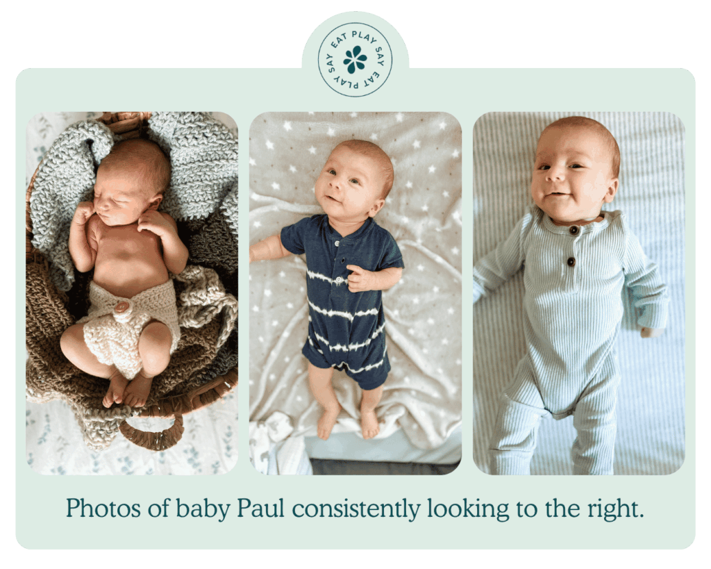 Paul would consistently look to the right when laying on his back as a young infant