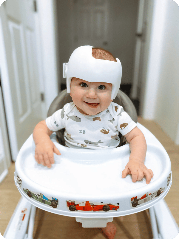 An infant wearing a Cranial Helmet sitting in a floor walker. He is smiling at the camera happily!